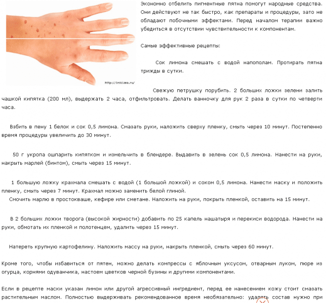 Пигментные пятна - как с ними бороться?