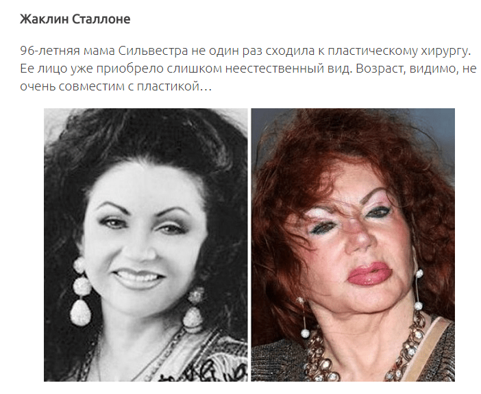 12 знаменитых женщин, побывавших в руках хирургов