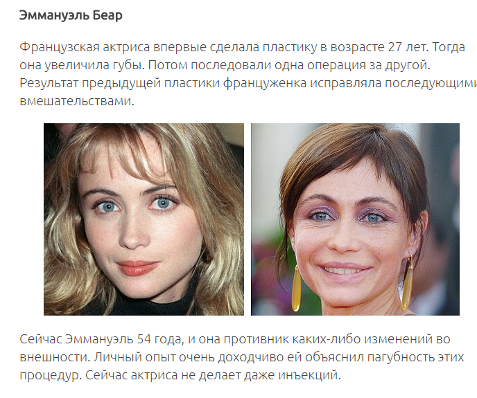 12 знаменитых женщин, побывавших в руках хирургов
