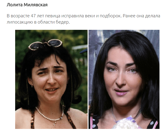 12 знаменитых женщин, побывавших в руках хирургов