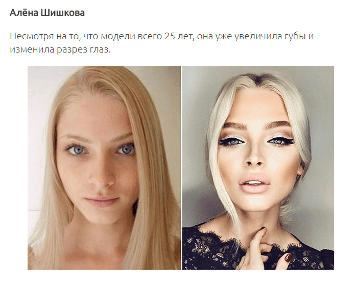 12 знаменитых женщин, побывавших в руках хирургов