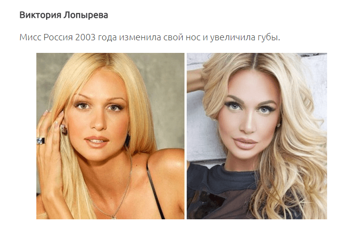 12 знаменитых женщин, побывавших в руках хирургов