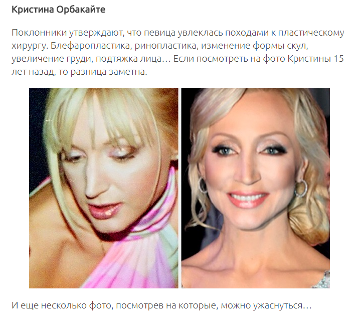 12 знаменитых женщин, побывавших в руках хирургов