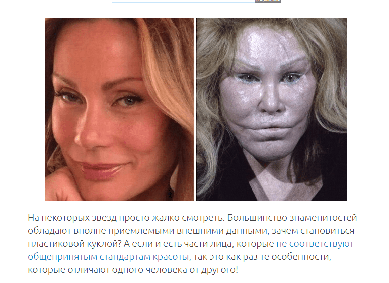 12 знаменитых женщин, побывавших в руках хирургов