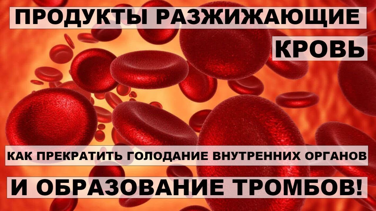 Кровь без тромбов. Продукты разжижающие кровь. Густая кровь разжижение,,,,,. Профилактика тромбообразования. БАДЫ разжижающие кровь.