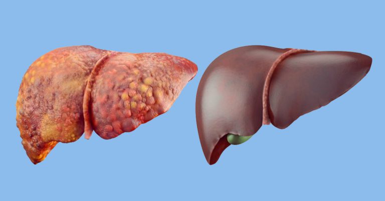 ТОП6 продуктов, которые быстро и эффективно очищают