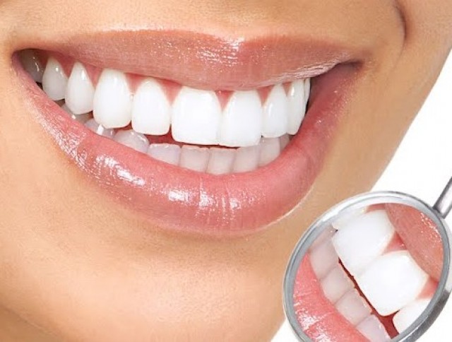 Хотите избавиться от зубного камня быстро и эффективно, без посещения стоматолога?